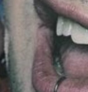 michael clifford canine teeth tweet media