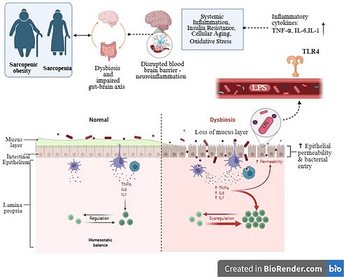 DelRealMartin2's tweet photo. Gut Microbiota as a Mediator of Sarcopenic Obesity: Mechanisms, Modifiable Factors, and Healthcare Burden

https://t.co/j56yyn0tvl https://t.co/XRanhqgXPx