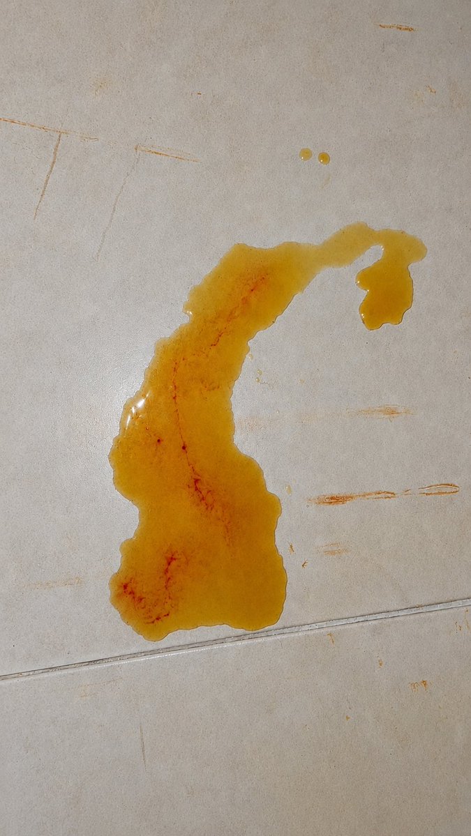 thaiannax's tweet photo. Passando para atualizar vocês sobre a Cacau. Ontem ela não fez nenhuma necessidade e como eu já havia comentado ela continua sem se alimentar sozinha e estamos oferecendo Recovery e água na seringa para mantê-la nutrida e hidratada.Hoje pela manhã ela fez xixi. A aparência continua a mesma, mas seguimos observando tudo de perto e fazendo o possível para cuidar dela da melhor forma. Também conseguimos vender alguns números da rifa, e somos muito gratos por cada pessoa que está ajudando. 💛

Quem puder colaborar comprando um número da rifa, compartilhando ou ajudando com qualquer valor para o tratamento da Cacau, fará uma grande diferença. Toda ajuda é muito bem-vinda e nos ajuda a continuar lutando por ela. Rifa atualizada 👇🏻❤️‍🩹 chave Pix 149.983.397-02
