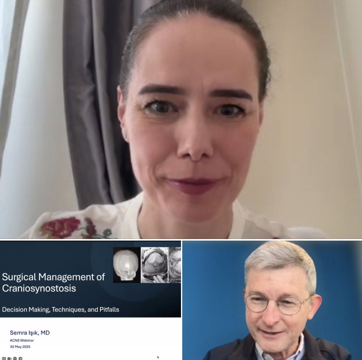 AsianCNS's tweet photo. We extend our sincere thanks to Prof. Semra Isik for the session 'Surgical Management of craniosynostosis : Pearls and Pitfalls' at @AsianCNS   webinar.
We also sincerely appreciate Prof.  Graham Fieggan @FiegsZA  for chairing the session.
This insightful academic session  featured renowned international experts sharing advanced perspectives and surgical strategies in craniosynostosis management.
Above all, we thank all 250 participants who  joined us and contributed to making the session a great success