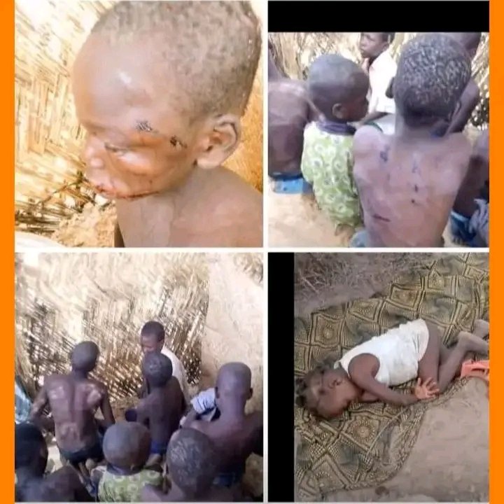 DaddyAl_Afc's tweet photo. #PresidentTinubu what offences did these kidnapped and tortured children commit?? Nigeria celebrated children's day on 27th May while these children were being inhumanly maltreated. #PresidentTinubu save your face for the love of these children. Bring them back https://t.co/aOhhyWTh4g