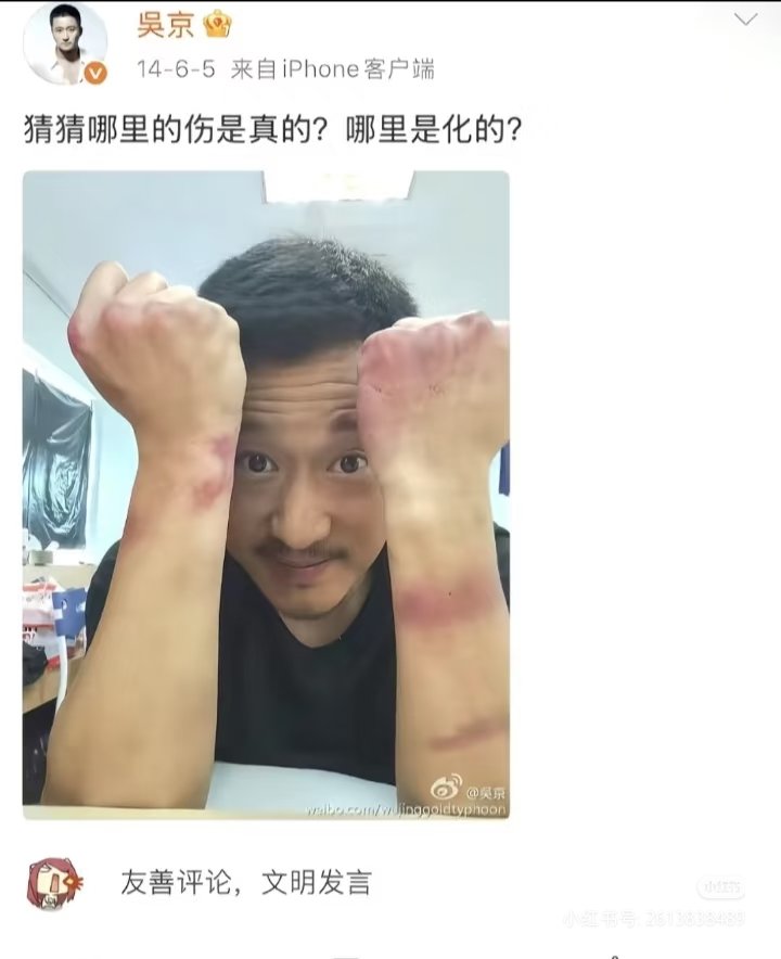 AnnYanQAQ's tweet photo. 猜猜哪里的伤是真的？哪里是画的？ https://t.co/eyFUGpk84a