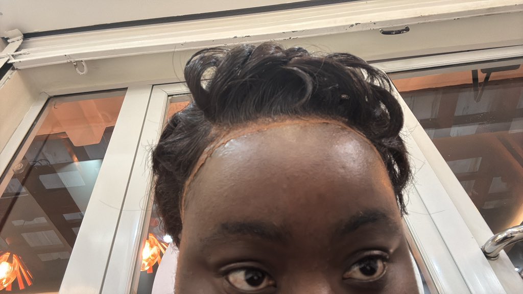 videtteadjor's tweet photo. As predicted it didn’t end well. Ladies and gentlemen my frontal. https://t.co/PBC955DfvB