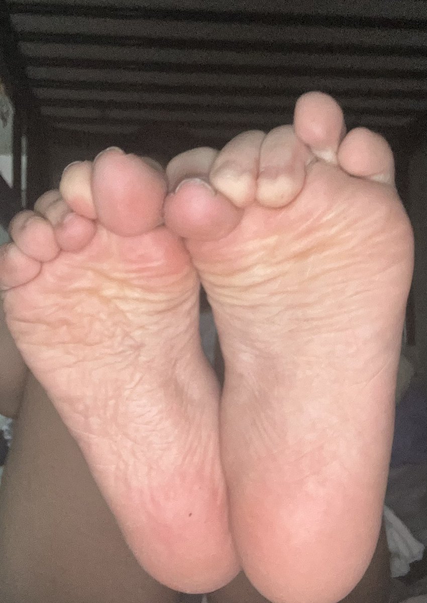 Feetlog_'s tweet photo. Te gustan arrugados? 😏 #feet #feetfetısh #findom #feet_pic https://t.co/wPmwqbW6Ad