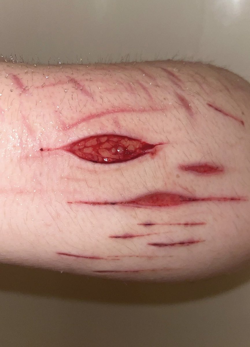 StrawberryCuts tweet media