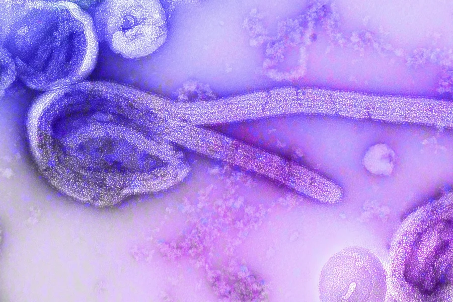 Metropoles's tweet photo. ⚠️ EBOLA | Suspeita de Ebola em SP: paciente isolado foi atendido em estado grave https://t.co/joLKvDwb70