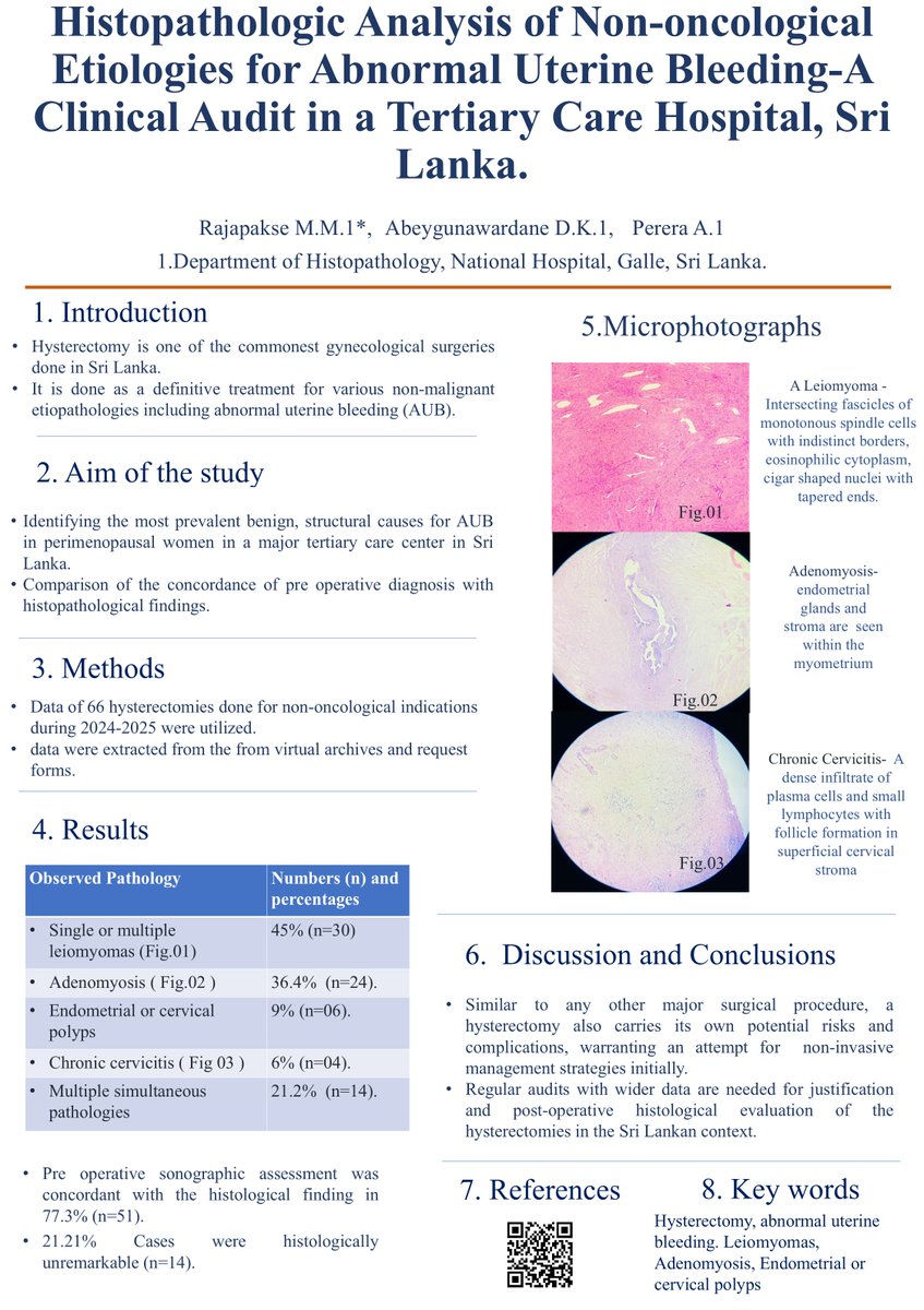 BAGPGynPath's tweet photo. #HilaryBuckleyAward This study evaluates hysterectomies performed during 2024-2025 within a tertiary care center, Sri Lanka, for non-malignant causes, presented with abnormal uterine bleeding   (AUB). This study focuses on underlying structural pathologies and the agreement between preoperative and histopathological diagnoses. Among 66 cases   (ages 40–55), the most common findings were Leiomyoma  (45%) and Adenomyosis (36.4%), with   smaller proportions showing polyps and chronic cervicitis. Multiple coexisting pathologies were seen in about one-fifth of cases. Preoperative ultrasound findings showed good concordance (77.3%) with histology, though a notable proportion (21.2%) had no significant histological abnormality. The study   highlights the importance of careful patient selection, the role of non-invasive management, and the need for ongoing audits to justify hysterectomy practices and correlate clinical and pathological findings. #BAGP2026