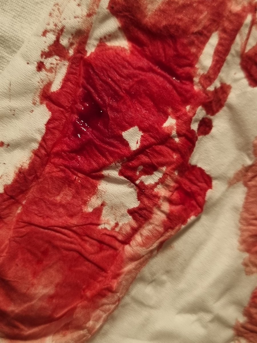BeepyBoop15610's tweet photo. Why does this look like a used pad... https://t.co/abJRfGRAGa