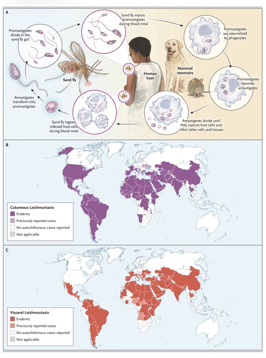 AliSMV7's tweet photo. 🔺Leishmaniasis (NEJM 2026)

https://t.co/XhOHmMNE07 https://t.co/CrclBI205f