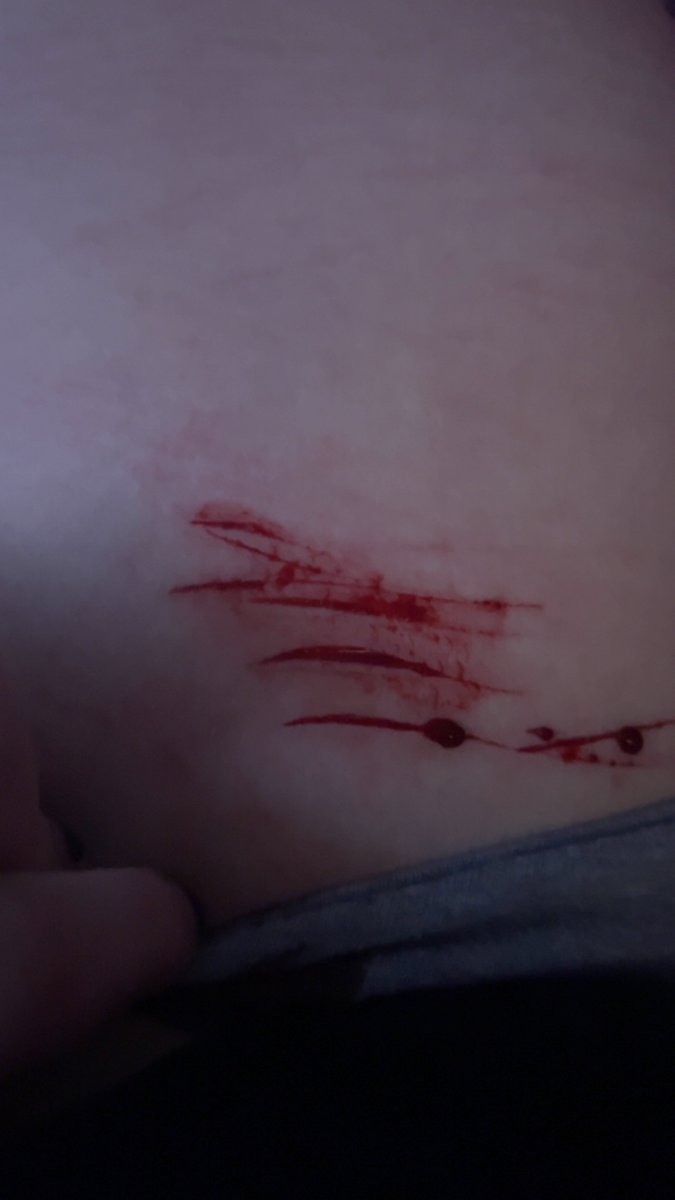 Hellokittylovrl's tweet photo. Some cuts I did, my bf is kinda being a pos rn #shedtwt #shtwt #shtなりきりさんがrtしてくれてそれを見たshtなりきりさんがきっとフォローしてくれる #slittwt #edtwt #anatwt
#miatwt #wItwt #eatingdisorder #skinny
#fat https://t.co/efdBnLEVZk