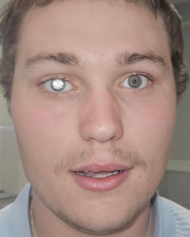 hrdevrythng's tweet photo. custom prosthetic eye made out of a 2-carat diamond https://t.co/FljdAUE2Xm