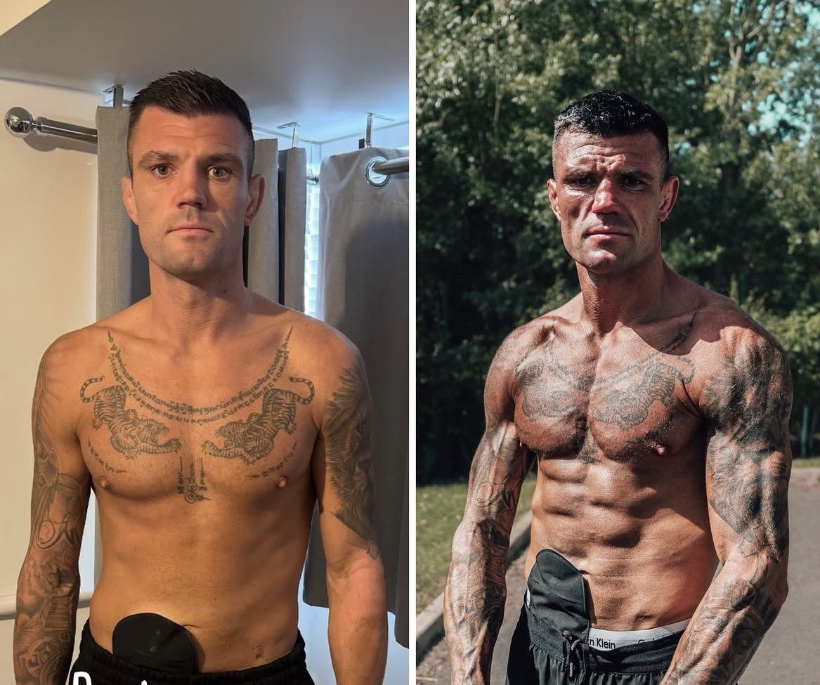 full_send_mma's tweet photo. Told he would never fight again, BKFC fighter Rico Franco won a world title tonight while fighting with an Ileostomy bag from bowel surgery

He has a guard that fits over his stoma and allows him to fight. Franco knocked down Connor Tierney 5 times in the main event in Birmingham https://t.co/z8XRnmrnT3