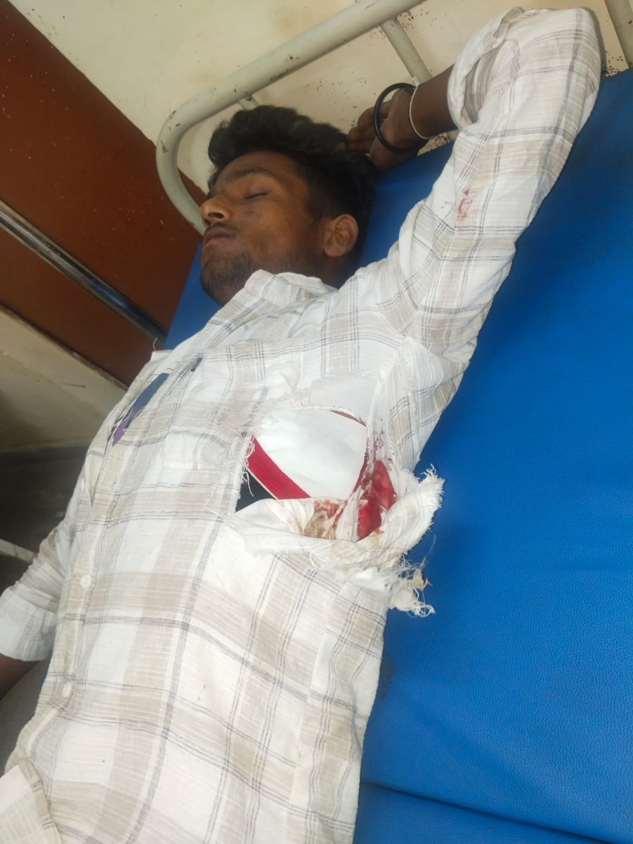 FastNewsInd's tweet photo. आगरा-अज्ञात वाहन ने बाइक को मारी जोरदार टक्कर

 हादसे में एक बाइक सवार की मौके पर ही मौत
दूसरा युवक  गंभीर रूप से घायल

थाना मनसुख पुरा क्षेत्र के बड़ापुरा के पास का मामला

#Agra @Uppolice
@agrapolice https://t.co/m5DRlhfyER