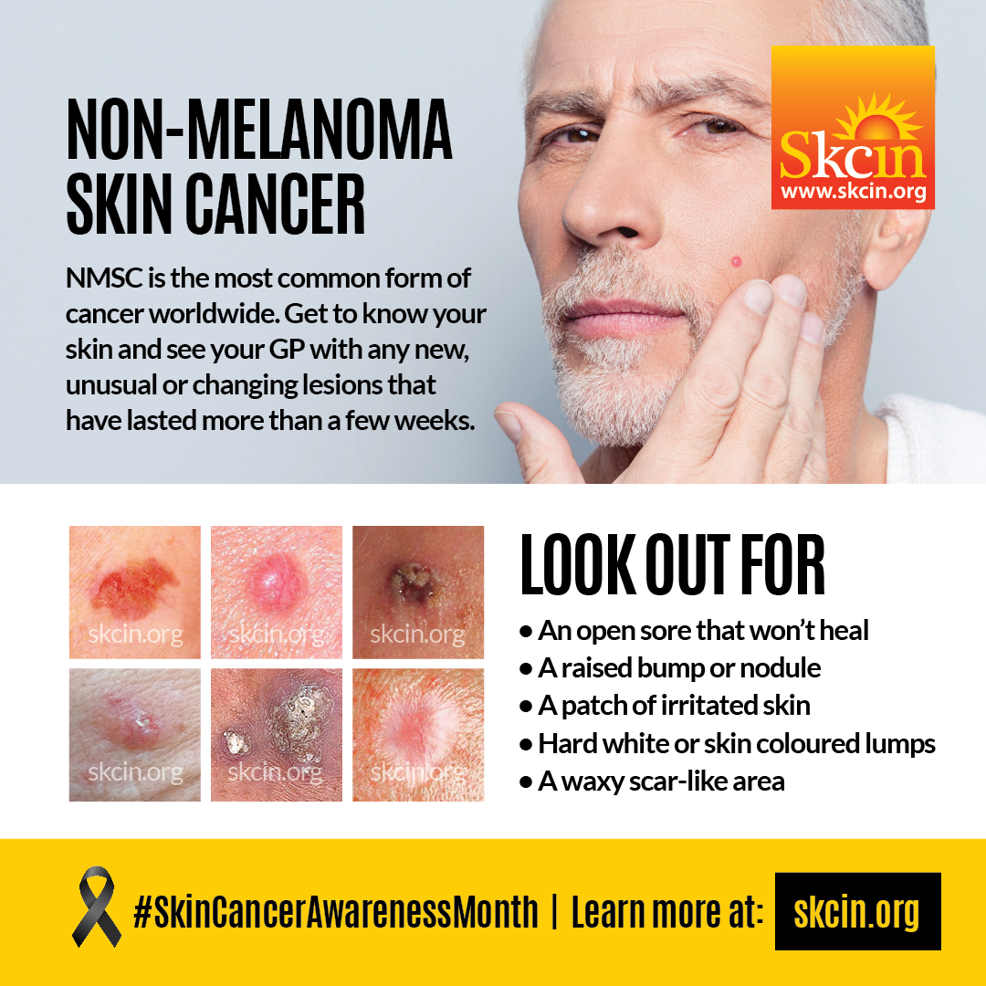 CancerNel's tweet photo. 🖤 Skin cancer awareness saves lives.

Hear more about protecting your skin in our podcast:
https://t.co/DohGt2E0fJ

Learn more: https://t.co/lf3T9iJcwV

#SkinCancerAwarenessMonth #SkinCancer #ProtectYourSkin #CheckYourSkin #Melanoma #CancerAwareness https://t.co/Lo2s5TZfuV