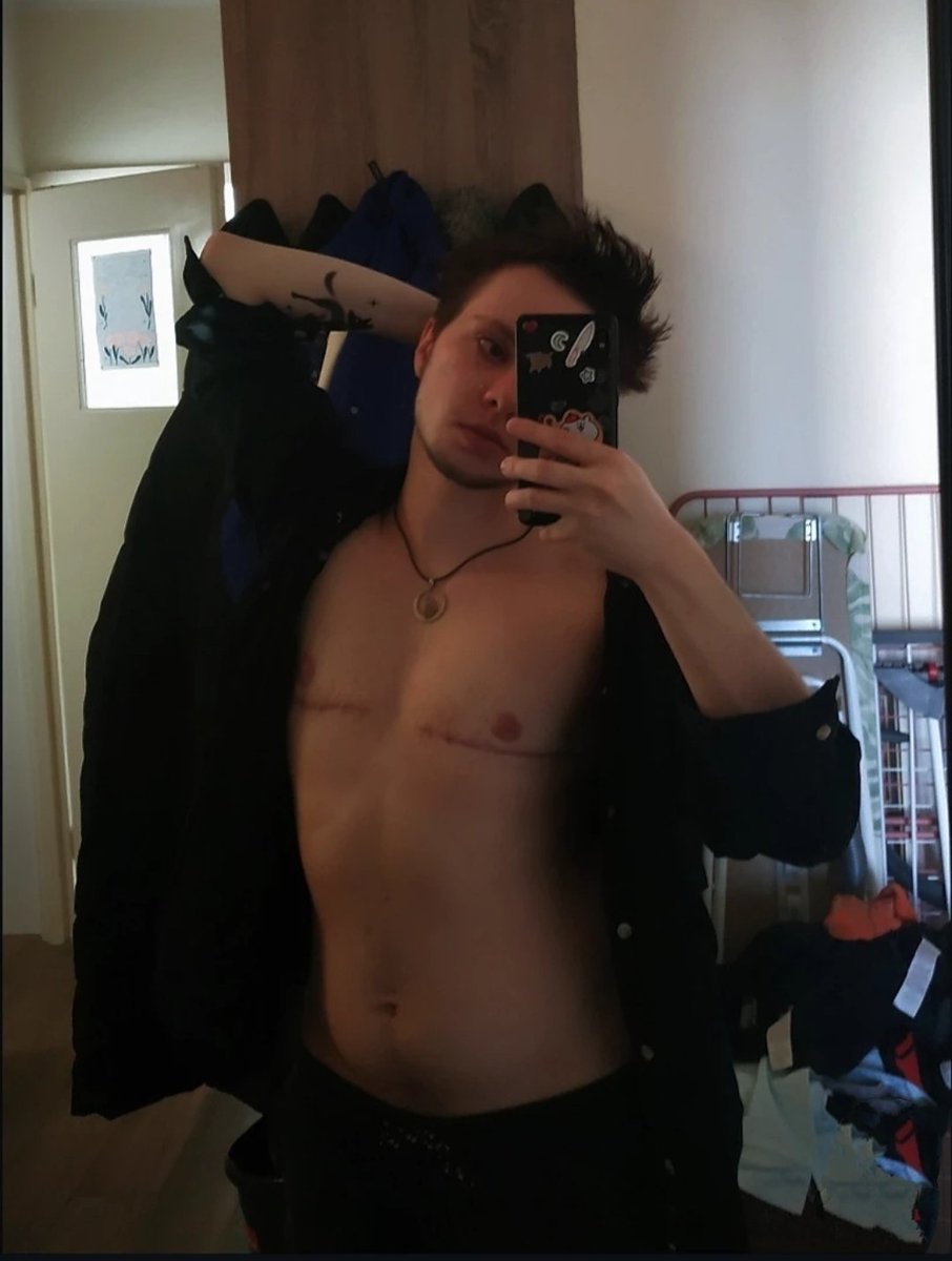 maxdym's tweet photo. Then and now.
I was Non-binary then
But it's hard af to fin photo of that era where I show my face XD mmm dysphoria was hitting hard https://t.co/iT4FAhyG3n