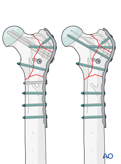 AOSurgery's tweet photo. Ready to deepen your knowledge of Dog proximal femur treatments?🐕

Explore the comprehensive AO Surgery Reference module on dog proximal femur for in-depth guidance, complete with detailed illustrations and case examples. 

➡️ https://t.co/SQnuj2KCKV

#AOVET #AOSurgeryReference https://t.co/xnWSueffrk