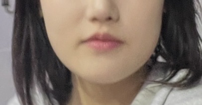 SeVveen_0's tweet photo. 4개월 동안 브이쎄라 + 괄사로 하관 정병 치료함

다들 윤곽 수술 생각하고 있다면, 괄사부터 꾸준히 해보자
실제로, 몸무게는 늘었는데 지인들이 살 왜이렇게 빠졌냐고 함
괄사로 꾸준히 관리하니까 얼굴라인 다듬어지고, 얼굴살 없어보임 !!!! 

(입술 필러도 추천함, 하관 여백을 좀 줄여줌

관리법 타래로 낋여볼게