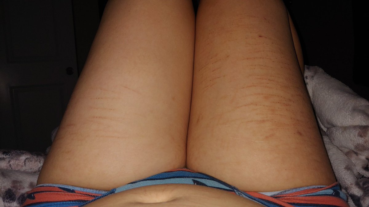 Dumbfag Aj cw: 67.5kgs-gw:55kgs tweet media