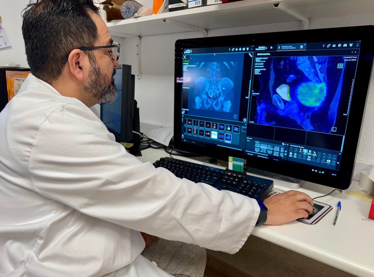 GVADrPeset's tweet photo. 🏥☢️El Hospital Doctor Peset incorpora la cirugía radioguiada y molecular para mejorar la localización de tumores complejos de columna. 

🔝Es la primera vez en Europa que se integra de forma sistemática el uso de radiofármacos en oncología vertebral. 

🔗 https://t.co/weKvIzb7Ft https://t.co/GVGJssVRpA
