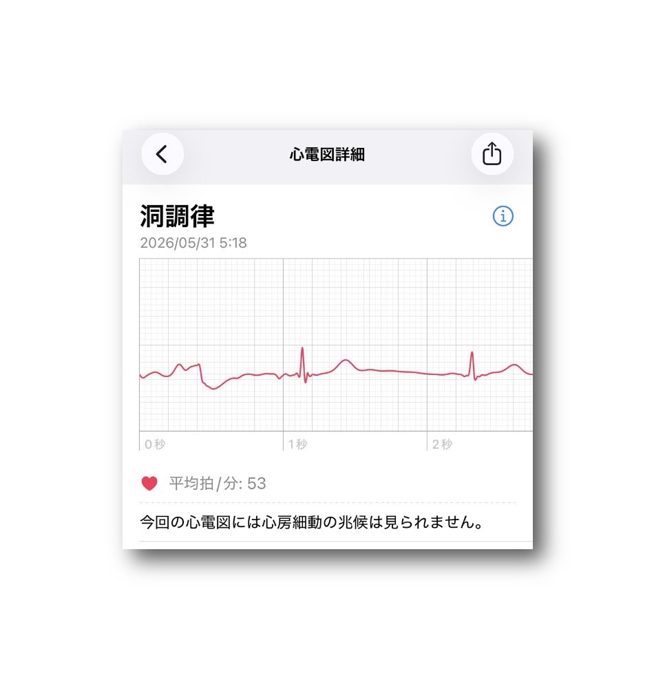 ヘルスケア 心電図 by Apple Watch 2026/5/31(日)5:18 洞調律 💓平均拍