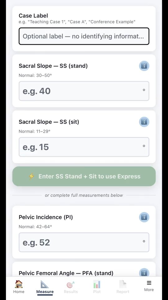 NationDevice's tweet photo. Seen the new "Cup Calc" app #orthotwitter ?

Using peer reviewed, trusted, and referenced calculations. CupCalc pulls together the literature on spinopelvic planning and gives you inclination and anteversion outputs for each case. 

Clearly labelled functional and anatomic outputs for either matching a standing AP x-ray or in reference to anterior pelvic plane respectively, depending on the technology you utilize.

You can be minimal and plug in only sacral slope standing and sitting and get an express calculation, or you can go pro and get detailed info on hip spine mobility and see just how safe is the safe zone. 

Congratulations Dr. Spencer Montgomery and Dr. Russell Bodner, you should be quite proud of this project! 

10% of revenue will be donated to Operation Walk USA annually. 

Free pro subscriptions for current arthroplasty fellows.

Find it on Apple App store here:
https://t.co/lOtKhljMSV