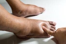 SAFO NYAME HERBAL THERAPEUTICS tweet media