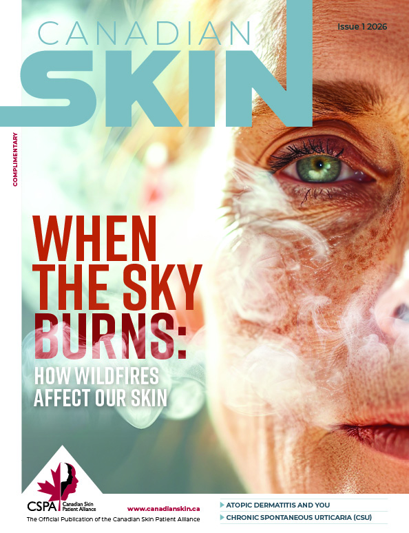 CanadianSkin's tweet photo. 📰✨ The Spring/Summer issue of Canadian Skin Magazine is here!
Patient-focused. Research-driven. Canadian.
📖 Read the latest issue now: https://t.co/RoyP7bBLFJ https://t.co/8I20qamKzH