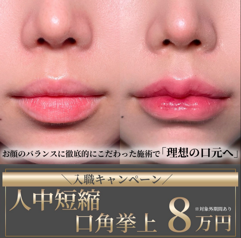 dr_fukuda_yasu's tweet photo. 【ご報告】

この度、10年間勤務していた湘南美容外科を退職し、6/1より新たなクリニックへ転職いたしました。

形成外科6年・大手美容外科10年で培ってきた経験を活かし、人中短縮・口元整形・鼻整形を中心に診療してまいります。

勤務は【銀座院・大阪院】を予定しております。これからも患者様お一人おひとりに合った美容医療をご提供できるよう努めてまいります。

🔗銀座院・ご予約
https://t.co/Qwsg4I4V42

🔗大阪院・ご予約
https://t.co/p364Ezd1mX