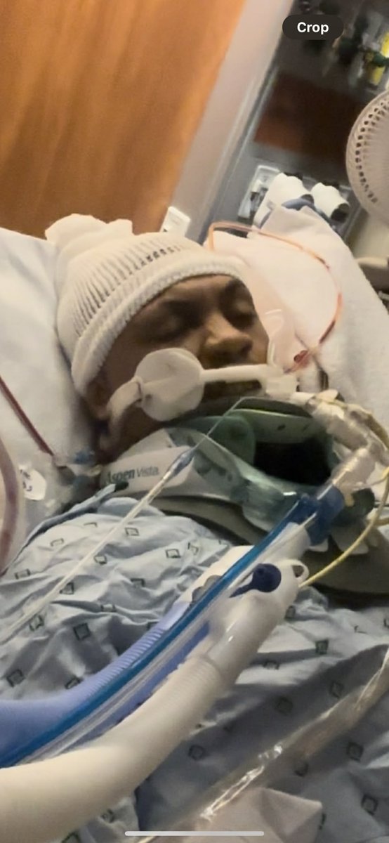 ZAEDAE7777's tweet photo. @Jayecane Got into a motorcycle Accident Unfortunately 🤦‍♂️.  broke my leg fractured my skull and displaced my spine Unfortunately.  it was very Traumatizing Doctor's said I was not going to wake up it was over but within 2 days from them saying that I randomly Woke up that's to oure Lord 🙏 https://t.co/YK5k1nvB6I