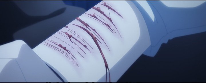 ʚ 𝕀𝕥𝕤𝕦𝕜𝕚 ɞ tweet media