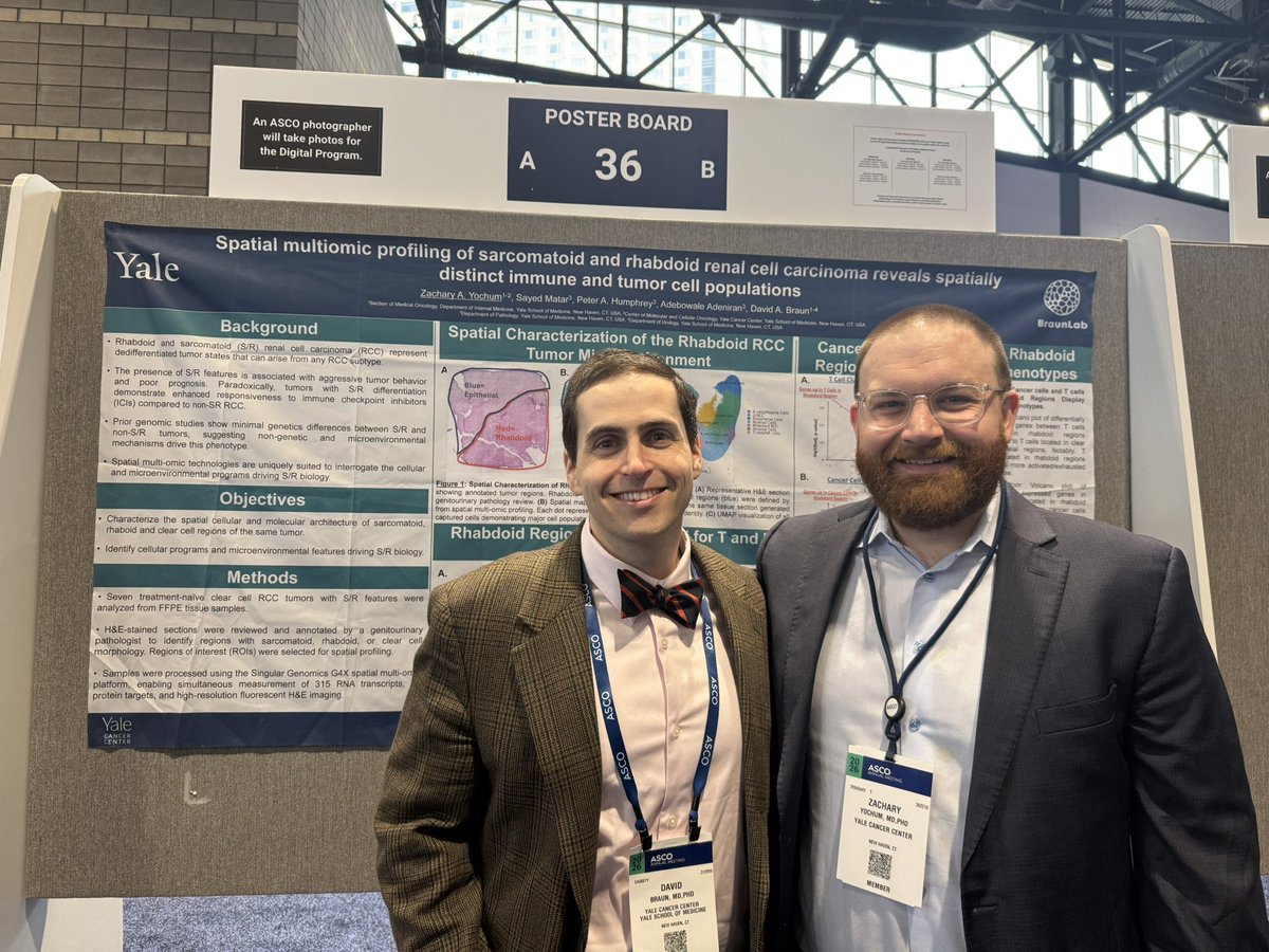 YaleCancer's tweet photo. .@BraunMDPhD & Dr. Zachary Yochum @YaleHemOnc at #ASCO26: Spatial multi-omics mapping of #kidney tumors showed aggressive rhabdoid/sarcomatoid regions are rich in immune cells, with T cells that appear both activated and exhausted. These findings may help explain why some high-risk tumors still respond to checkpoint immunotherapy. @ASCO @SmilowCancer @OncoAlert
