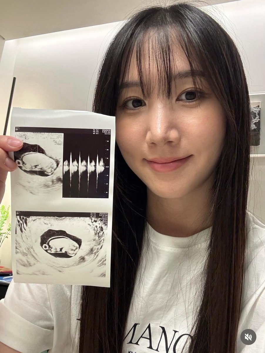 hlxnews_HQ's tweet photo. #YUKYUNG announced that she is expecting a baby through her latest Instagram post and shared a heartfelt message with her fans.

She revealed that she has entered her 16th week of pregnancy and is now in a stable stage, allowing her to finally share the news publicly. Yukyung also introduced her baby's nickname, "Dangdang," explaining that she chose the name with the hope that the child will grow up strong and confident.

As a first-time mother, she expressed both excitement and nervousness about the journey ahead, asking for fans' love and support as she learns and grows into her new role. She also warmly invited fellow mothers to share advice and experiences with her.

💙👶 Congratulations to Hong Yukyung on her pregnancy announcement! ✨🫶🏻

—
instagram caption eng trans:
Everyone, a precious little baby has come into my life 🥹🤍

I've been wanting to share this news with you for so long, but I had to keep it to myself for a while..! Now that I've entered my 16th week of pregnancy and reached a more stable stage, I'm finally able to make this announcement. ✨

Our baby's nickname is Dangdang 👶🏻🤎 We chose it with the hope that our baby will grow up strong and confident.

I'm still a first-time mom who doesn't know much yet, but I'll do my best to learn and become a wonderful mother. I hope you'll continue to watch over us and send us lots of love and support. 🫶🏻

If there are any fellow moms here, let's communicate and prepare for this journey together~!

Dangdang, grow up healthy and strong, and let's meet soon. I love you. 🦄💙
#임밍아웃 #맘띠맘 #16주차 

#홍유경 #HONGYUKYUNG