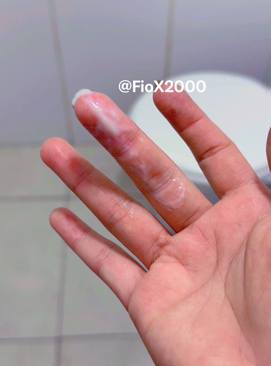 FioX2000's tweet photo. Uppppsss🔥 https://t.co/244edFHzCQ