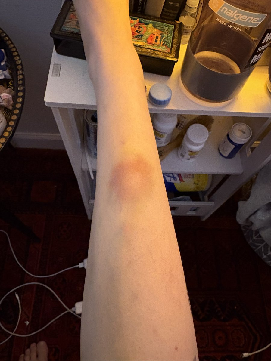 abookofsymbols's tweet photo. it’s hard to demonstrate how banged up i am without this being nsfw but suffice it to say it truly takes brave strong man to shove an unarmed anorexic chick to the ground multiple times !! https://t.co/y5JocQdSyR
