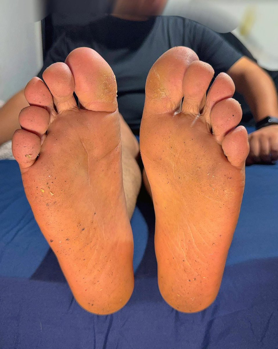 AdrianFeets's tweet photo. My dirty soles

#malefeet #malesoles #mensfeet #gayfeet #footmaster #malefeetmaster #giantfeet #maletoes #boyfeet #maletoes #gayfootfetish #malefootfetish #manfeet
#bigfeet #masterfeet https://t.co/n1Y8aDdFxK