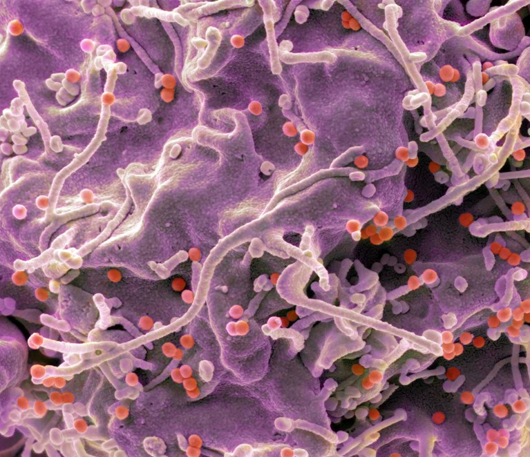 NightSkyToday's tweet photo. 🚨: An Experimental HIV vaccine successfully triggered right immune response in 47 of 48 people breaking a 40 years barrier. https://t.co/xBvVLLdfuI