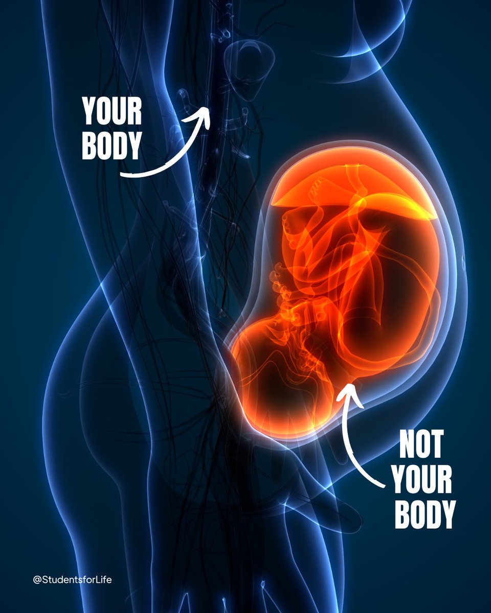 KristanHawkins's tweet photo. Sunday Reminder:

The baby's body is not your body, therefore not your "choice." https://t.co/INkcwiITbW