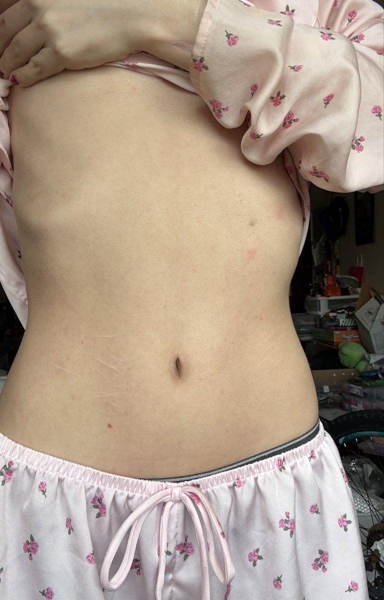 fuchs_cuts's tweet photo. BC because I’m out of food and no one in my family will help out so I’m going hungry until I get my food stamps next week so YAY!!!! Last time I weighed I was 98lbs but idk maybe I gained😭 https://t.co/whu1fsC277