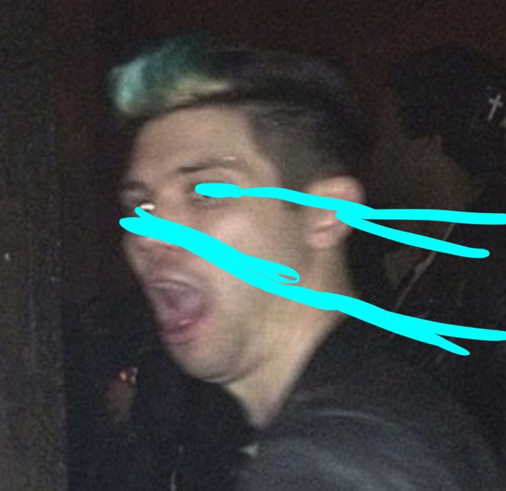 Ryan Ross Toothy Hole tweet media