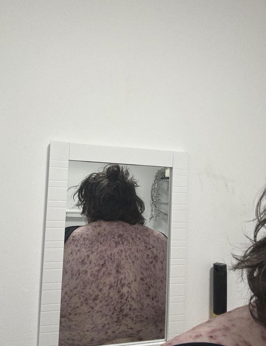 antinomlenda's tweet photo. Comecei a tomar anabolizante, esteroide e fazer ciclo GH achando que aí ficar forte e olha aí o resultado… pqp

O negócio é assistir anime mesmo, paguei 2k no curso online do cariane atoa, aguarde o processo cariani https://t.co/ICNeUaICXJ