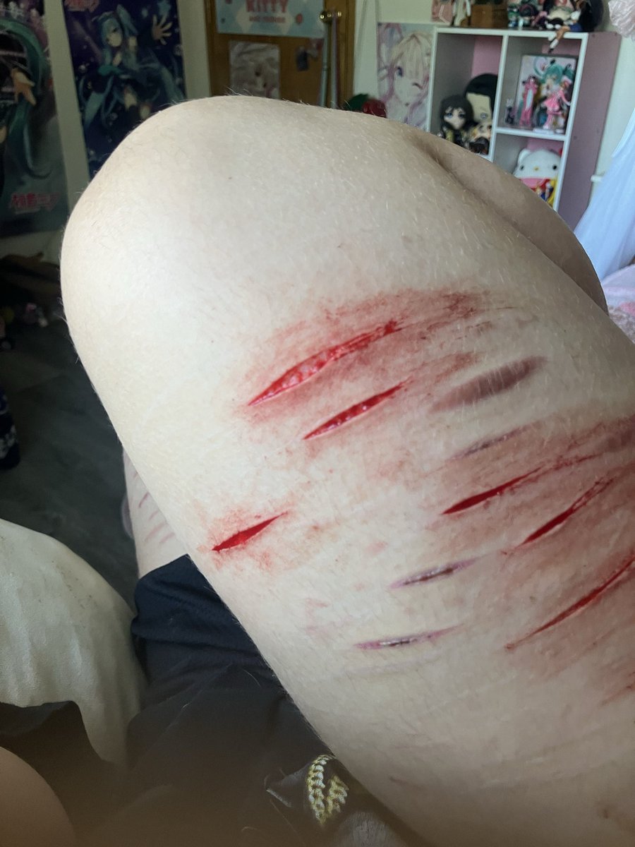 kuuDoll_'s tweet photo. Holy shrinkage omfg 💔💔💔 #shedtwt #redink https://t.co/C5D6kbzucZ