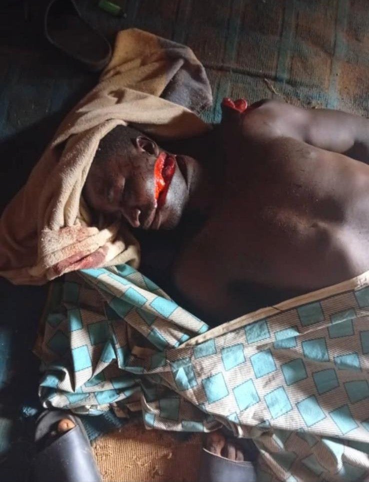 HighChiefOkoro's tweet photo. WARNING: Graphic Images 

Children, Women and Men slaughtered in Imo State last night by IPOB terrorists.

Peter Obi and his influencers will not talk about the innocent Igbo people that were killed in this gruesome attack. https://t.co/Ial6ZEpxH7