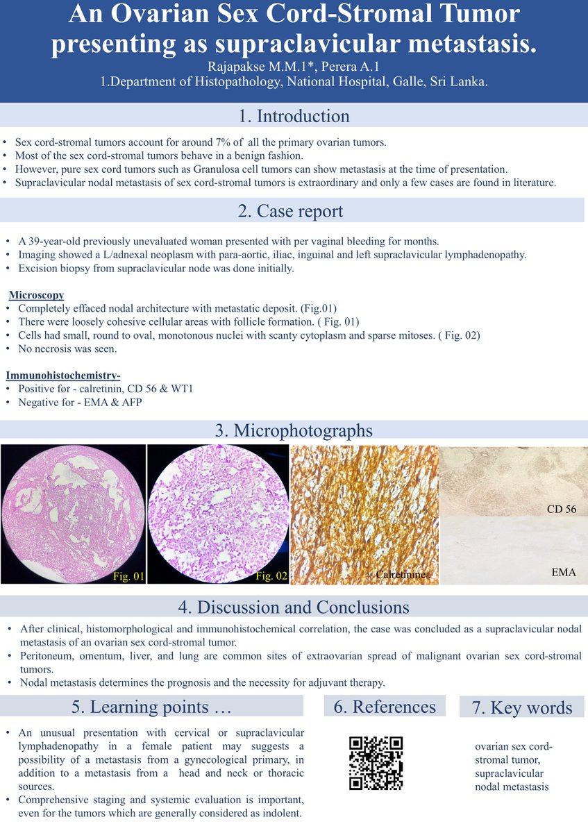 BAGPGynPath's tweet photo. #HilaryBuckleyAward  rare metastatic pathway from ovary to neck – ovarian sex cord-stromal tumor presenting with Virchow’s node. #BAGP2026 https://t.co/T2y9zEcagL