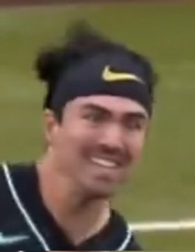 MicrobesTalk's tweet photo. @skostyboi This face didn’t age well https://t.co/occa0uQzXU