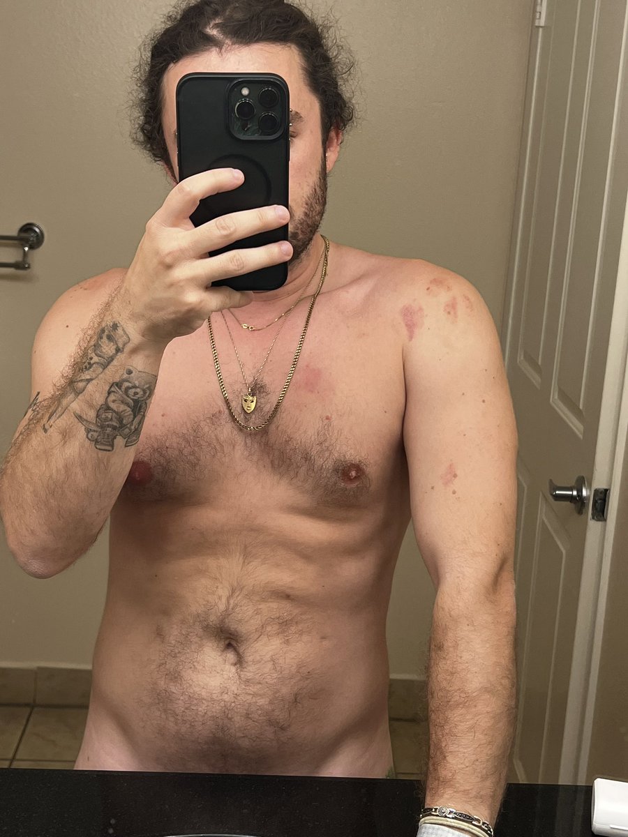 LordSweets's tweet photo. Hickies got me feeling yummy https://t.co/B77CflWH9V