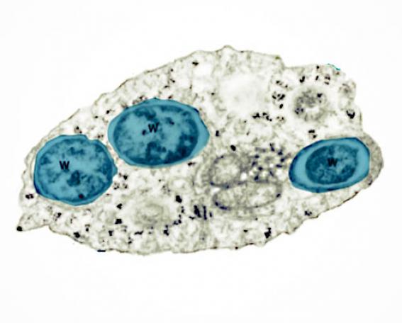 suleymanercin's tweet photo. 👉Wolbachia👈
Artropodları (eklembacaklılar) enfekte eden bakteridir.

Wolbachia, sivrisineğin vücudunda dang veya Zika gibi virüslerin çoğalmasını ve dolayısıyla insandan insana bulaşmasını bloke edebilir.

Biyolojik sivrisinek mücadelesinde çok önemli yer tutacaktır.
https://t.co/qVwGsJPix3…