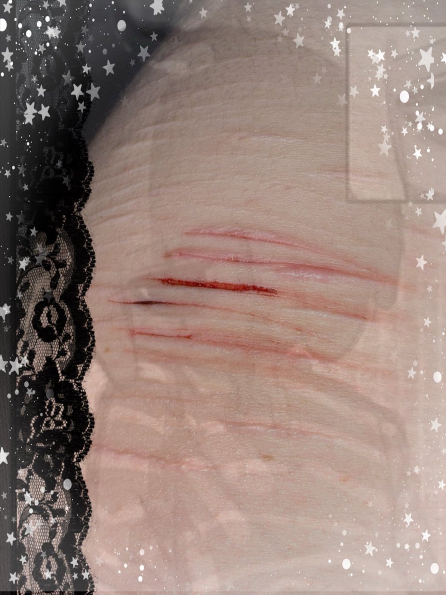 cvtncute's tweet photo. No new shesh yet, but uhm these are my scales :3 #shtwt #slitt #sledtwt #cute https://t.co/LrQsudiXRh