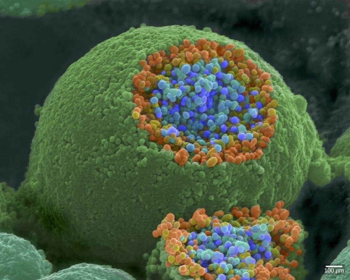 InterestingSTEM's tweet photo. This is the appearance of a nerve ending. 

It has been opened to reveal vesicles (shown in orange and blue) that contain the chemical messengers used to transmit signals within the nervous system. https://t.co/qG01qqQzaV