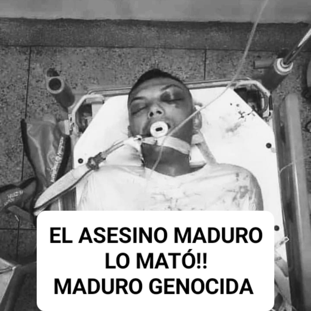 miguelgali1771's tweet photo. Y
MATÓ MUCHÍSIMOS!!! https://t.co/YMJlN1ViCQ