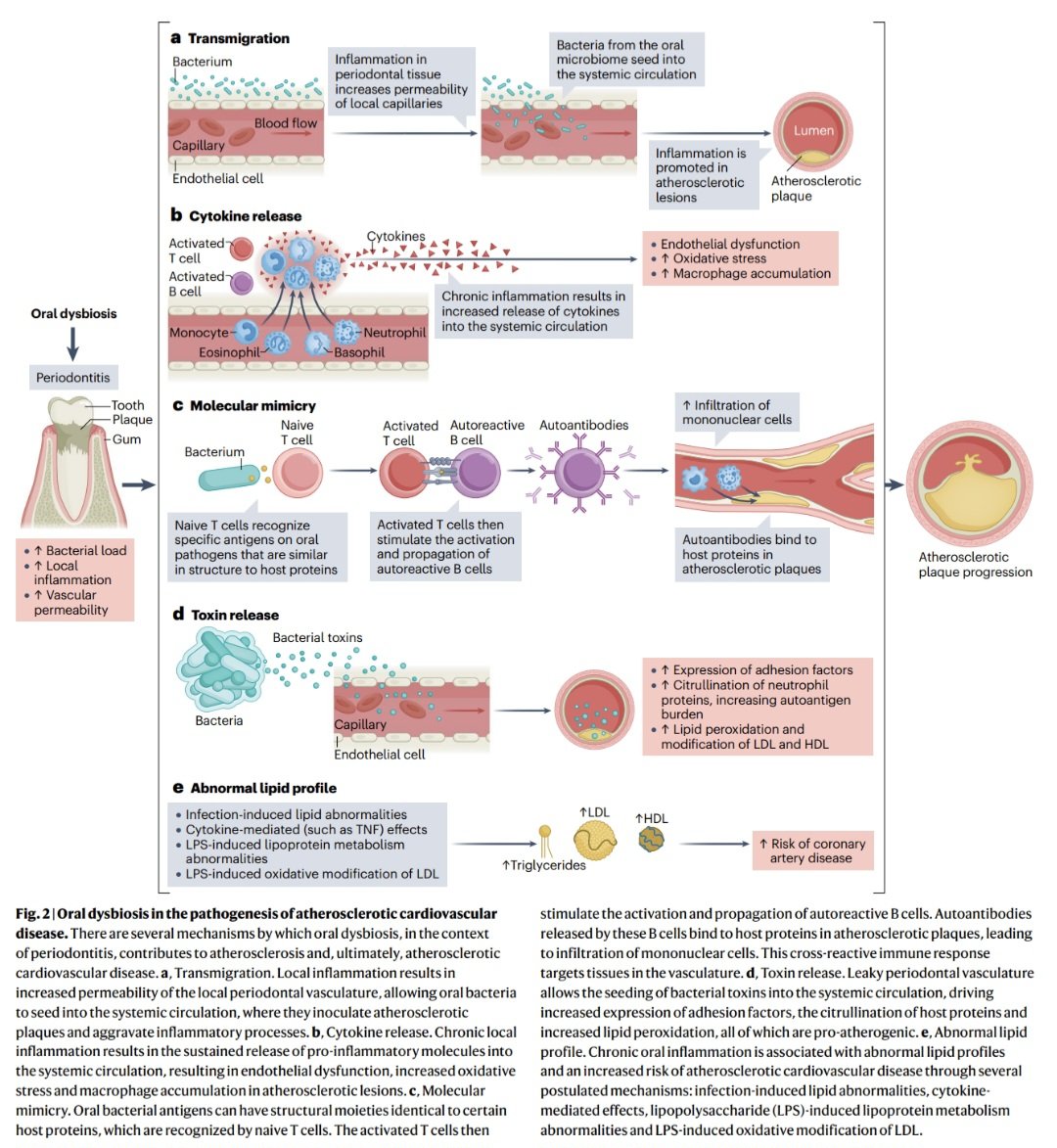 javier20ch's tweet photo. El microbioma oral en la Enf. Cardiovascular. 🧐🦠💥🫀
🟢La cavidad oral alberga más de 770 especies microbianas y constituye el segundo microbioma más diverso del organismo después del intestino. Cuando este ecosistema pierde su equilibrio (disbiosis), especialmente en presencia de periodontitis, puede convertirse en un promotor activo de inflamación cardiovascular. ❤️‍🔥🔥
🟢La periodontitis se asocia con un aumento del 24% en el riesgo de enfermedad coronaria y la pérdida dentaria con un incremento del 34%. La periodontitis aumenta hasta 5 veces el riesgo de enfermedad arterial periférica. 📈❤️‍🩹
🟢En el estudio ARIC, la enfermedad periodontal se relacionó con un mayor riesgo de ictus cardioembólico (HR 2.6) y trombótico (HR 2.2), mientras que la atención dental regular redujo el riesgo de evento cerebrovascular (HR 0.77). 🧐🔎
🟢La disbiosis oral también puede contribuir a la IC mediante inflamación sistémica, endotoxemia y alteraciones del eje boca-intestino-corazón, favoreciendo fibrosis miocárdica y progresión de la enfermedad. 🫀💥

📄🆓️⤵️
https://t.co/FkdYcj7oRm
https://t.co/KcqAxsickg